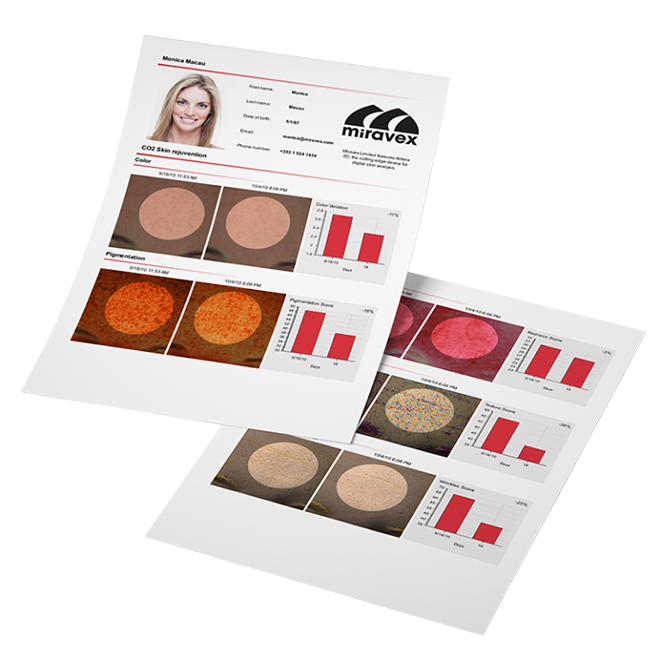 レポート作成機能